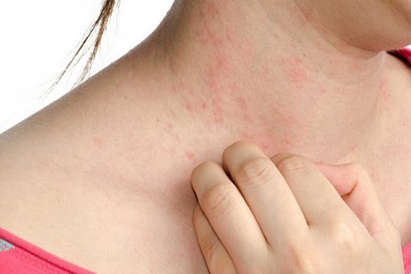 Những ai không nên uống nhụy hoa nghệ tây