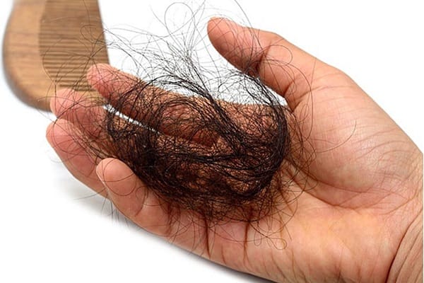 Nguyên nhân rụng tóc sau sinh