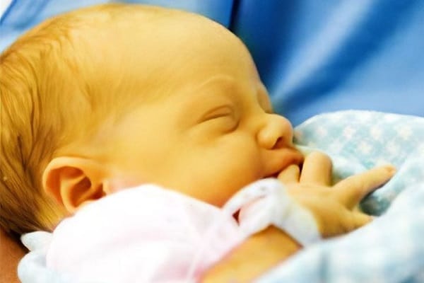 Nguyên nhân dẫn đến vàng da ở trẻ sơ sinh